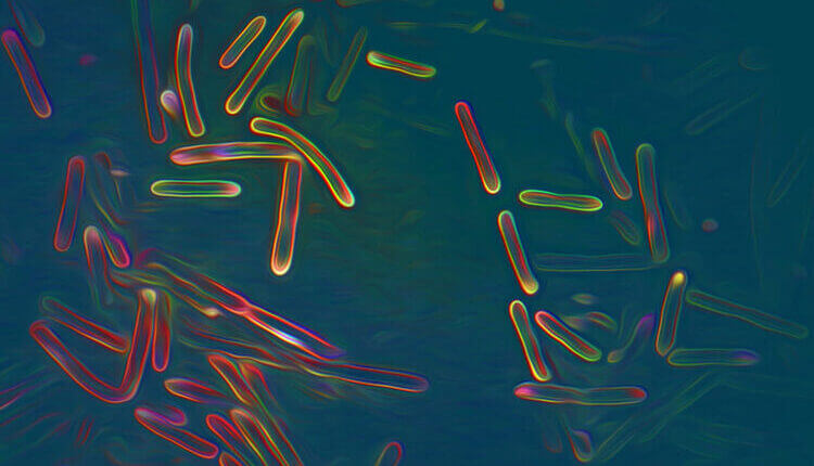 تصویر آنتوسروتیباکتر پانامنسیس (Anthocerotibacter panamensis)