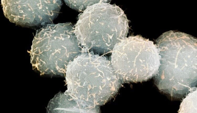سلول‌های بنیادی برای انتقال ژن‌های بازسازی کننده برای درمان کودکان دچار نقص شدید ایمنی