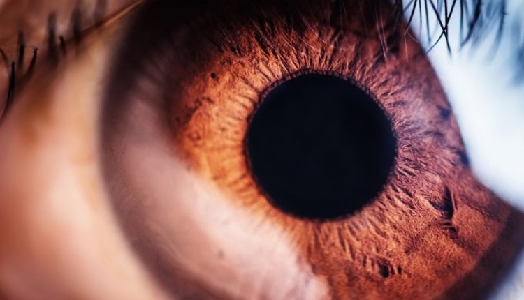 کیمترک را به‌عنوان درمانی برای ملانوم داخل چشم (uveal melanoma)