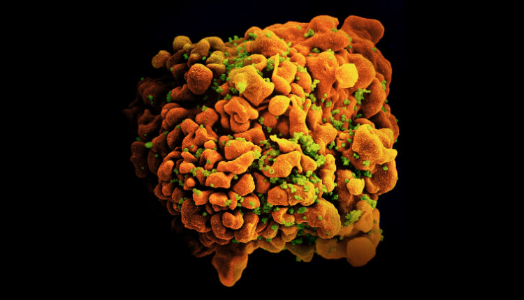 تصویر میکروسکوپ الکترونی از یک سلول T نوع H9 آلوده به HIV. تصویر از انستیتو ملی آلرژی و بیماری‌های عفونی (NIAID)،