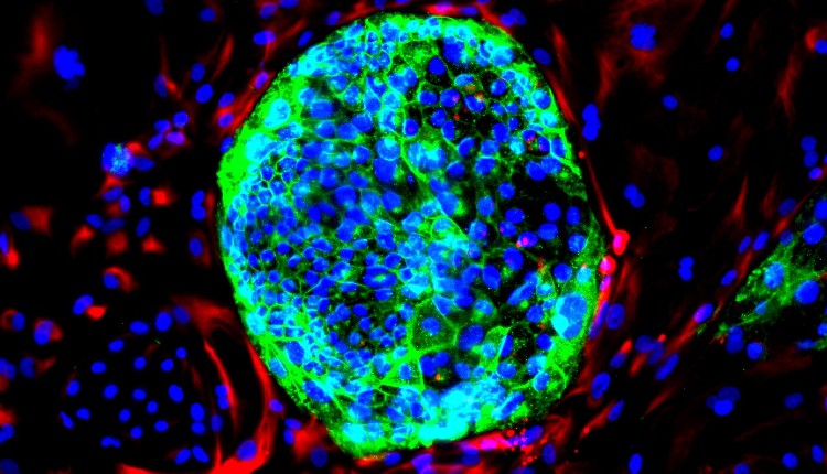تصویر میکروسکوپ فلورسنت از سلول‌های مزودرم خارج جنینی و سلول‌های بنیادی پیش ساز جفت