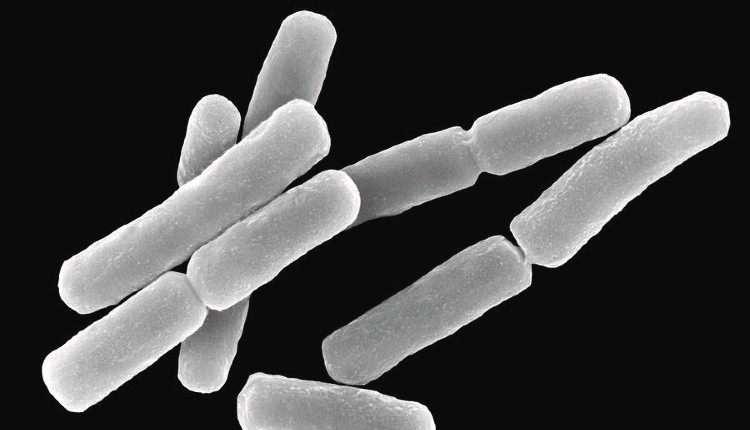 باکتری Bacillus anthracis عامل سیاه‌زخم