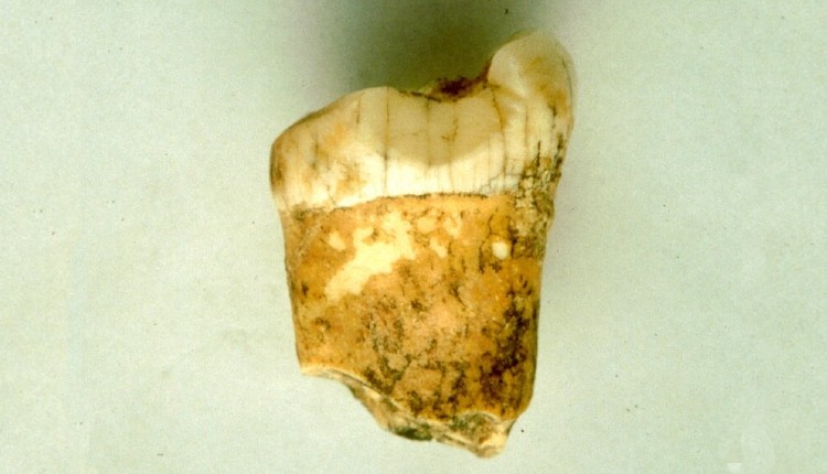 نخستین دندان آسیا نئاندرتال