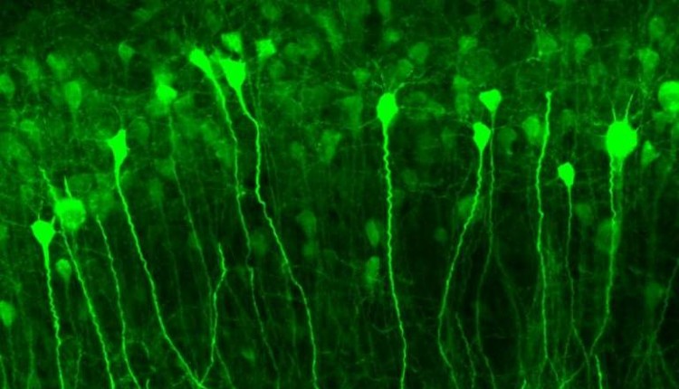 نورون‌های cfos-GFP هیپوکامپی