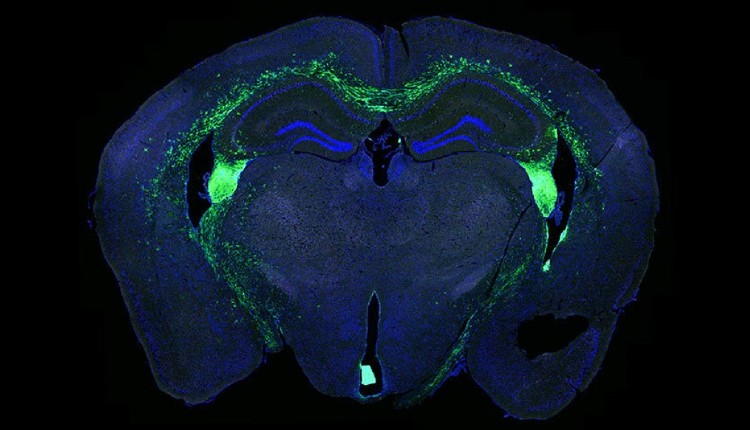 برش بافتی از مغز موش با سلول‌های بنیادی عصبی پیوند شده به آن