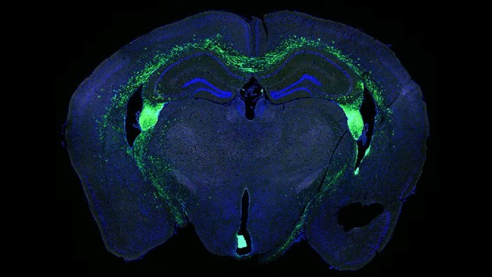 برش بافتی از مغز موش با سلول‌های بنیادی عصبی پیوند شده به آن