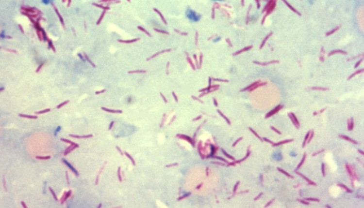 مایکوباکتریوم لپره (Mycobacterium leprae)