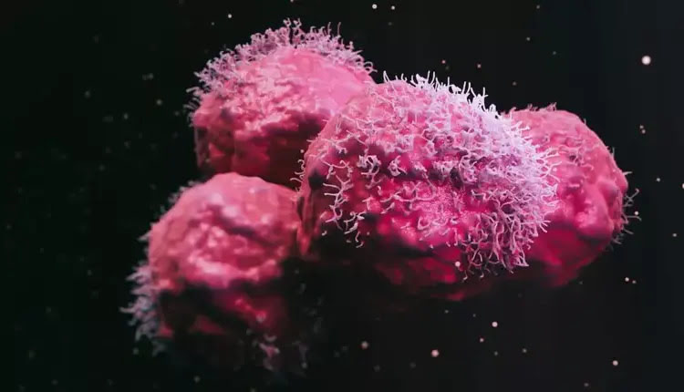 تصویری از چندین سلول سرطانی در یک توده