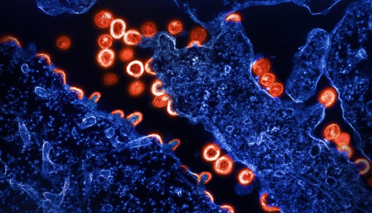 تصویر میکروسکوپ الکترونی از ذرات ویروس HIV-1 (قرمز) که از بخشی از سلول H9 آلوده (آبی) جوانه زده و تکثیر می‌شوند.