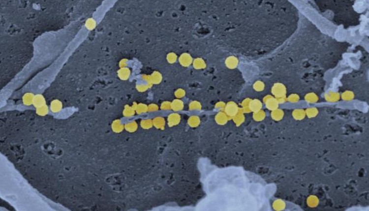 تصویر میکروسکوپ الکترونی از ویروس تب کریمه کنگو